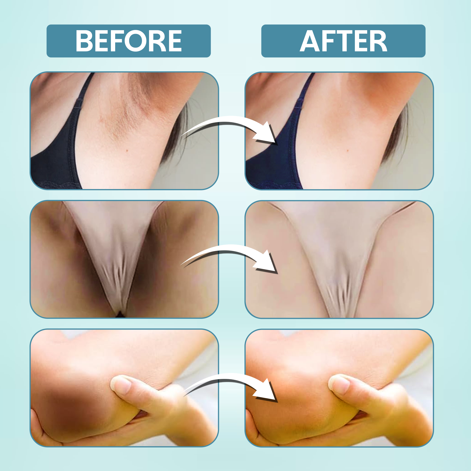 Private Parts Whitening Cream for Dark Body Parts and Intimate Area | Brighten your Vagina, Under Arms, Elbows, Knees or any other Body Area that Looks Darker with Natural Ingredients Formula